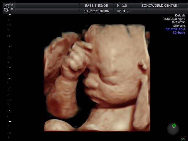 Klinik Untuk Scan / Ultrasound Baby : Klinik My Family By MySonoworld