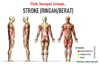 Herbal Center Ads | Titik Tempel Koyo One More Untuk Stroke (Ringan/Berat/Gejala)