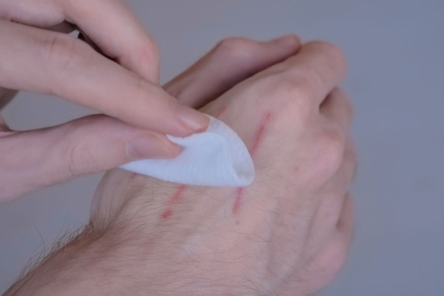 How to Properly Treat Cat Scratches