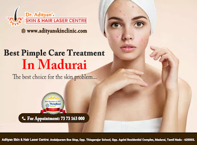 http://adityanskinclinic.com/treatments.php