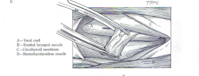 Teknik Operasi Laringotomy pada Hewan (Bedah Thoraks)