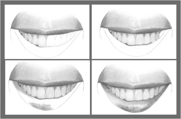 Karakalem ile ağız ve dişler nasıl çizilir adım 3