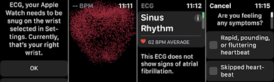 خذ ECG