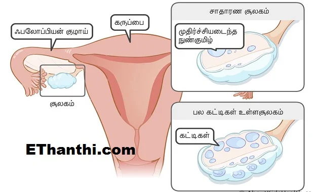 பிரச்னைக்குக் காரணம் என்ன?