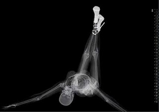 Backscatter X-Ray Images very very Sexiest