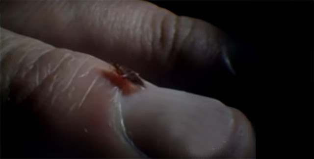 Bed Bug on Finger