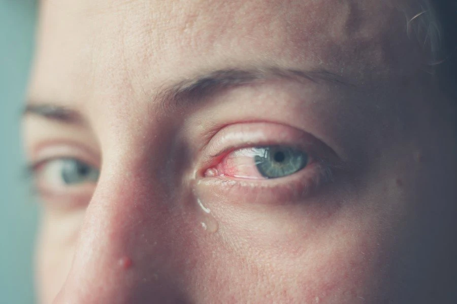 Göz sağlığını korumanın 8 yolu