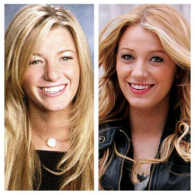 blake lively nose