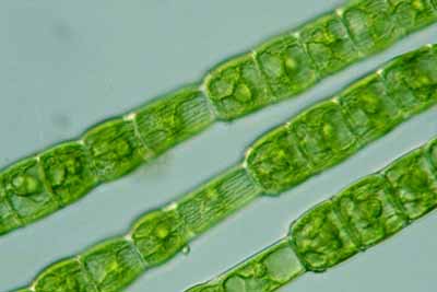 6 Jenis Chlorophyta Ganggang Hijau Contoh Gambar  