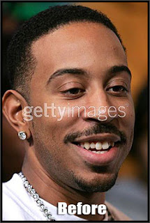 ludacris new teeth