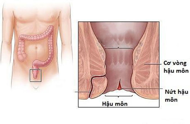 Nguyên nhân gây nứt kẽ hậu môn và cách chữa trị