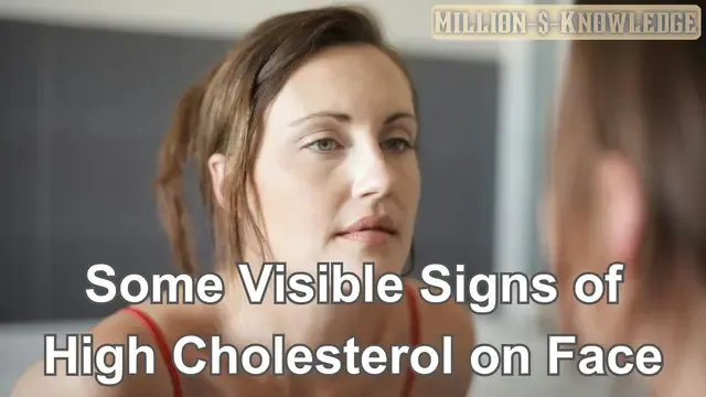 Signs of High Cholesterol on Face