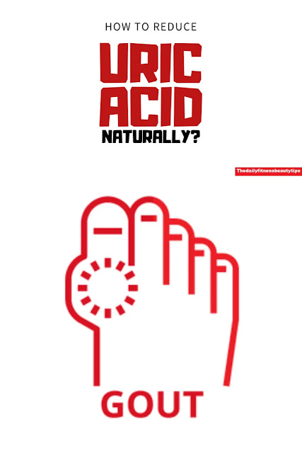 Uric-acid-gout-treatment