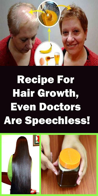 RECIPE FOR Hair Growth, Even Doctors Are Speechless!