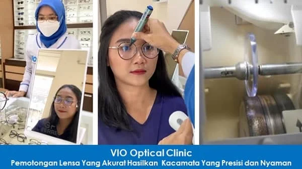 vio optical clinic