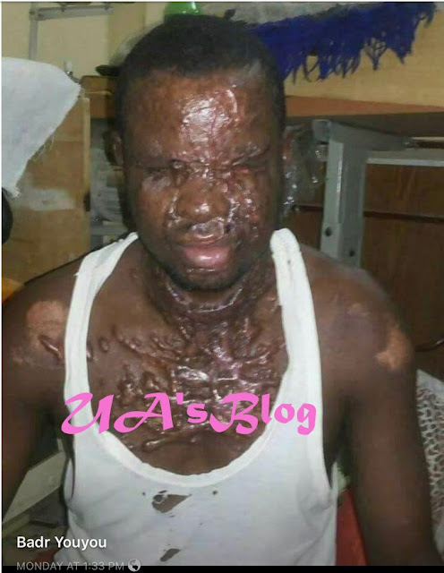 Libyans Pouring Molten Plastic On Black Skin, Eyes And Face (Graphic Photos)