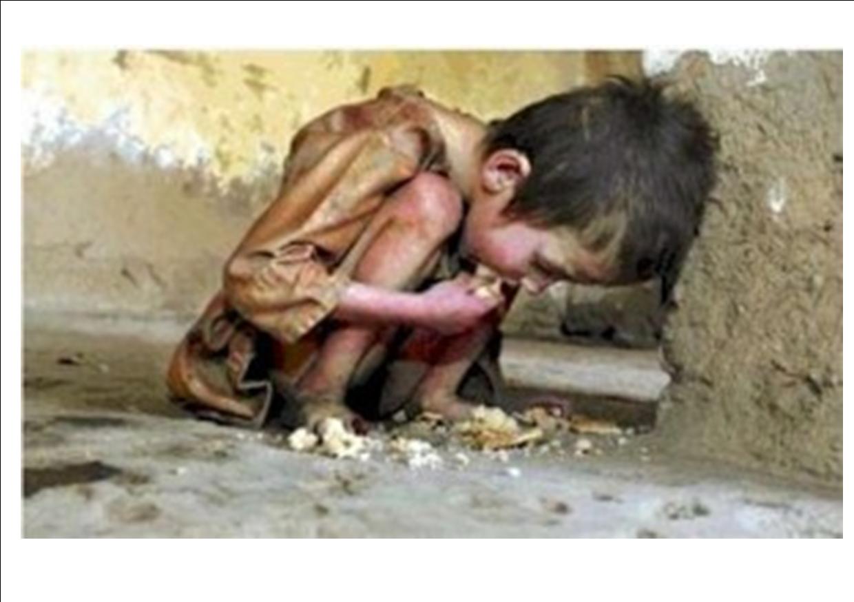 stop world hunger