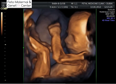 Ultrasound Dubai