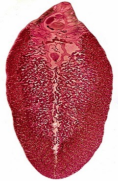 FACIOLA- LIVER FLUKE 