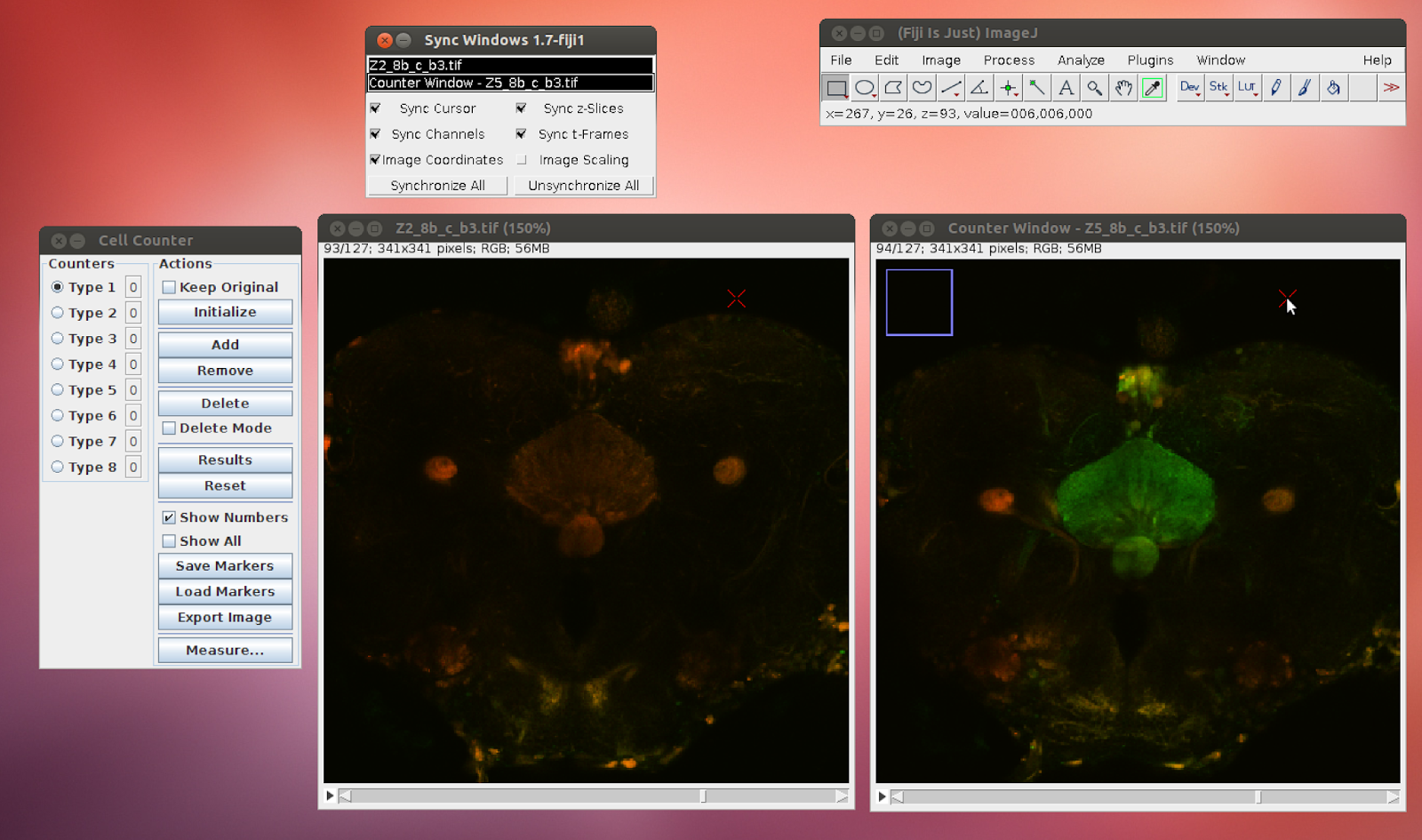 Useful Information Using Imagej To Count Cell Bodies In