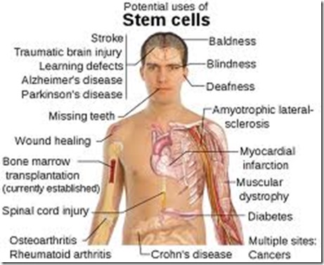 stem cell treatment