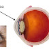 University of Nottingham scientists discover undetected layer in the cornea