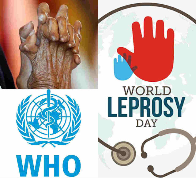 newztabloid-WHO-newzsnips-Leprosy-WHO-Poonam-Khetrapal-Leprosy