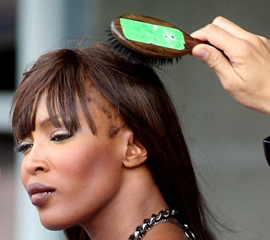 naomi campbell hairline. It is being said that Naomi