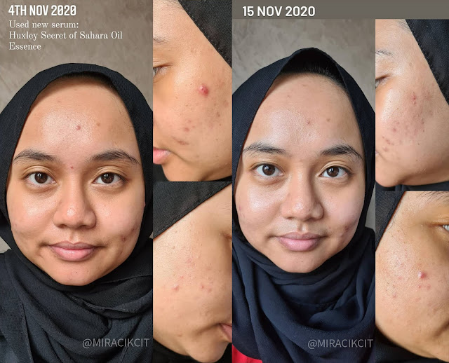 Before and After using Huxley Oil Essence Review