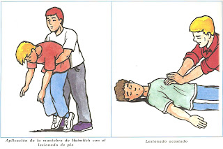 Resultado de imagen para primeros auxilios en caso de asfixia