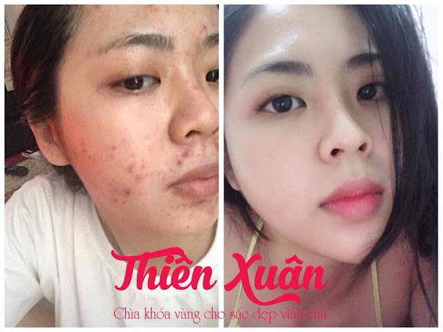 430K - Bột trắng da Thiên Xuân - thảo dược - Hoài Thương Organic