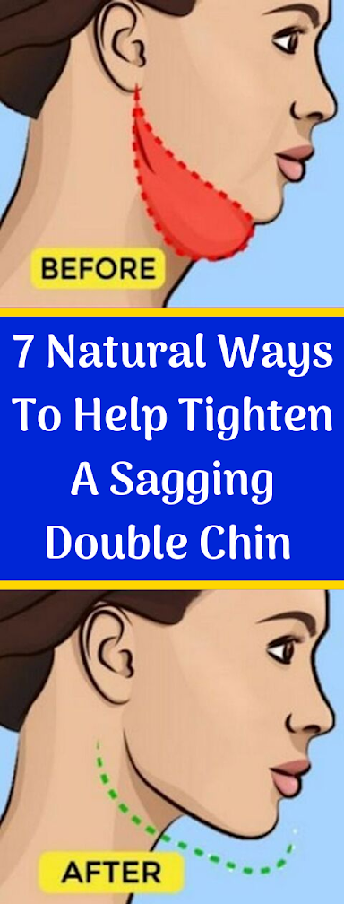 7 Natural Ways To Help Tighten A Sagging Double Chin