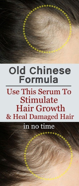 Old Chinese Formula Use This Serum To Stimulate Hair Growth