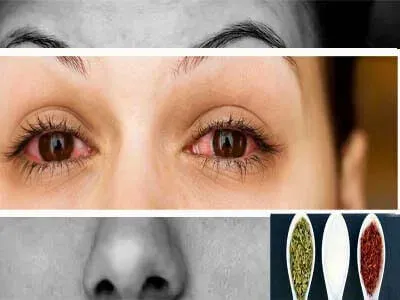 علاج التهاب العين بالاعشاب