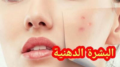 البشرة الدهنية