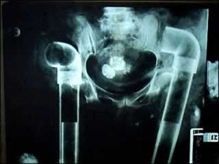 Unbelievable X-rays (12) 7