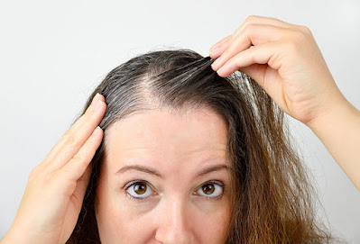 soy hair loss in women