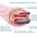 The Benefits in Stem Cells From Umbilical Cord Tissue