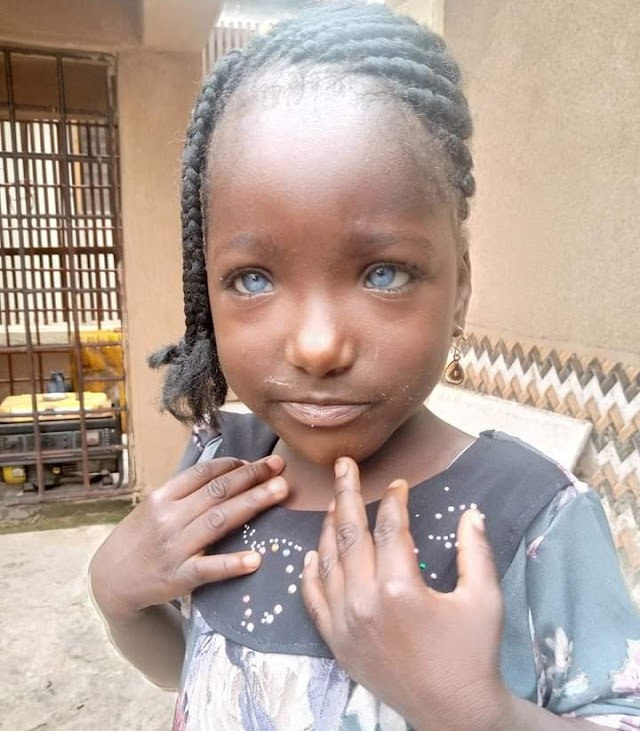 Man Rejects Daughter In Kwara State Because She Has Blue Eyes.