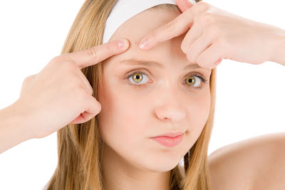 ACNE TYPES AND HOME REMEDIES FOR GIRLS