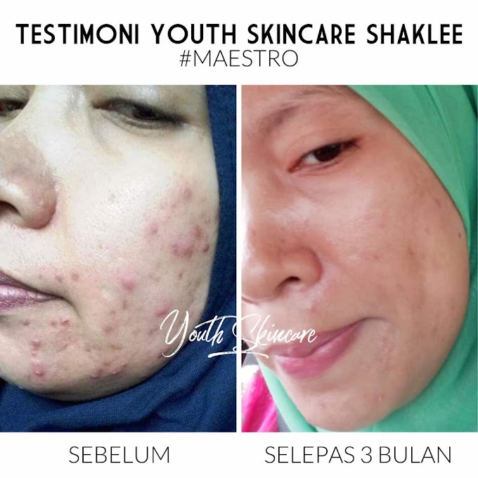 Koleksi Testimoni YOUTH Skincare Shaklee Dari Team Kami