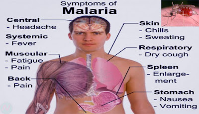 Malaria