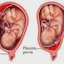 MASALAH URI DI BAWAH / PLACENTA PREVIA : ADAKAH BAHAYA