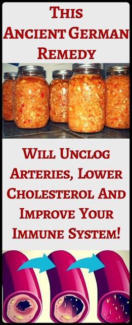 Ancient German Remedy That Will Unclog Arteries, Lower Cholesterol And Improve Your Immune System!