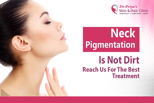 Best Pigmentation Treatment In Bangalore