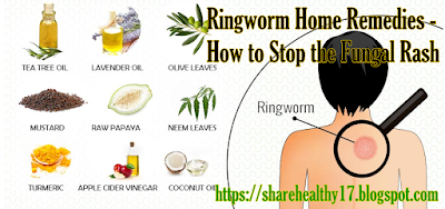 Ringworm Home Remedies - How to Stop the Fungal Rash