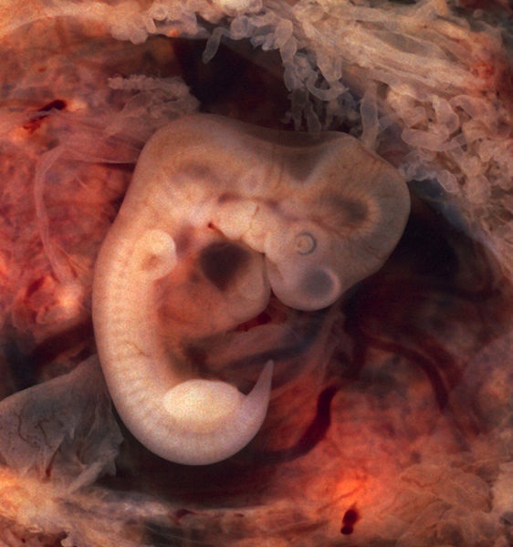 images of 5 week fetus. I looked at pictures of 5 week