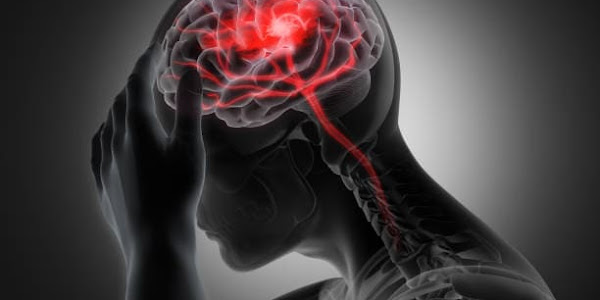 Health experts have expressed concern over the increase in stroke rates