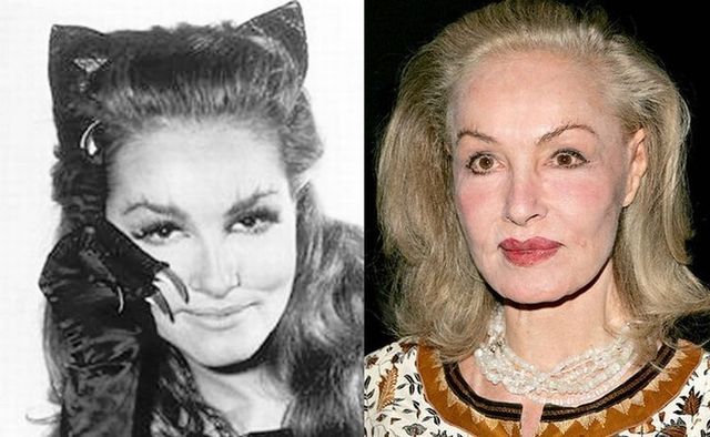 Julie Newmar before and after plastic surgery