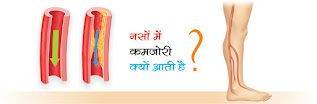 नसों में कमजोरी क्यों आती है Why Does Weakness Occur In The Veins in hindi, Why Weakness Comes In Veins in hindi, nerve weakness or neuropathy is a medical condition, which collectively define various nervous disorders, yog vyayam naso ki kamjori ke liye in hindi, नसों की कमजोरी दूर करें nason ki kamjori door karein in hindi, नसों की कमजोरी का घरेलू इलाज hindi, home remedies for veins in hindi, शरीर की नसों को स्वस्थ कैसे रखें how to keep the body's nerves healthy in hindi, नसों की कमजोरी के कारण nason ki kamzori ke karan in hindi, नसों में कमजोरी क्यों आती है? why weakness comes in veins? in hindi, nason mein kamajori kyon aati hai? in hindi, naso ki kamzori ka ilaj ayurvedic in hindi, naso ke dard ka gharelu ilaj in hindi, sir ki naso me dard ka ilaj in hindi,  sir dard kyu hota hai in hindi, why is there weakness in the veins? in hindi, naso ki sujan ka gharelu ilaj in hindi, nash dard ki dawa in hindi, veins image, veins photo, veins jpeg, veins pdf, veins pdf article in hindi, veins problem in hindi, vein pain in hindi, nerve weakness or neuropathy is a medical condition, which collectively define various nervous disorders in hindi, identification of weak nerves in hindi, how to avoid nerve weakness? in hindi, effective for weak nerves in hindi, vein pain in hand in hindi, vitamins for vein health in hindi, supplements for vein health in hindi, oil for vein health in hindi, supplements to strengthen blood vessels in hindi, how to improve blood circulation naturally in hindi, सक्षमबनो इन हिन्दी में, sakshambano, sakshambano ka uddeshya, latest viral post of sakshambano website, sakshambano pdf hindi,